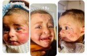 Leishmaniasis Control Project in Al-Raqqa, Syria