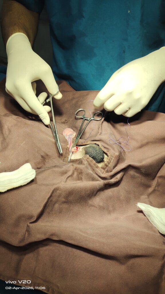 Surgery in Progress