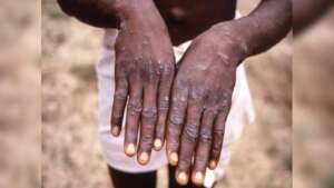 Provide essential medicines
