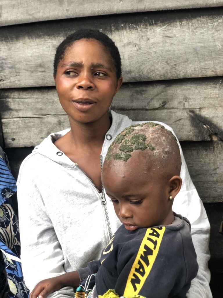 Training  vulnarable women in  soap making