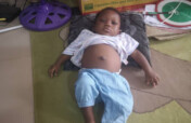 Save 4-Month-Old Shalom: Urgent Liver Transplant