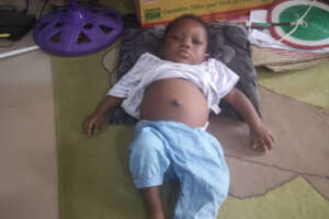Save 4-Month-Old Shalom: Urgent Liver Transplant