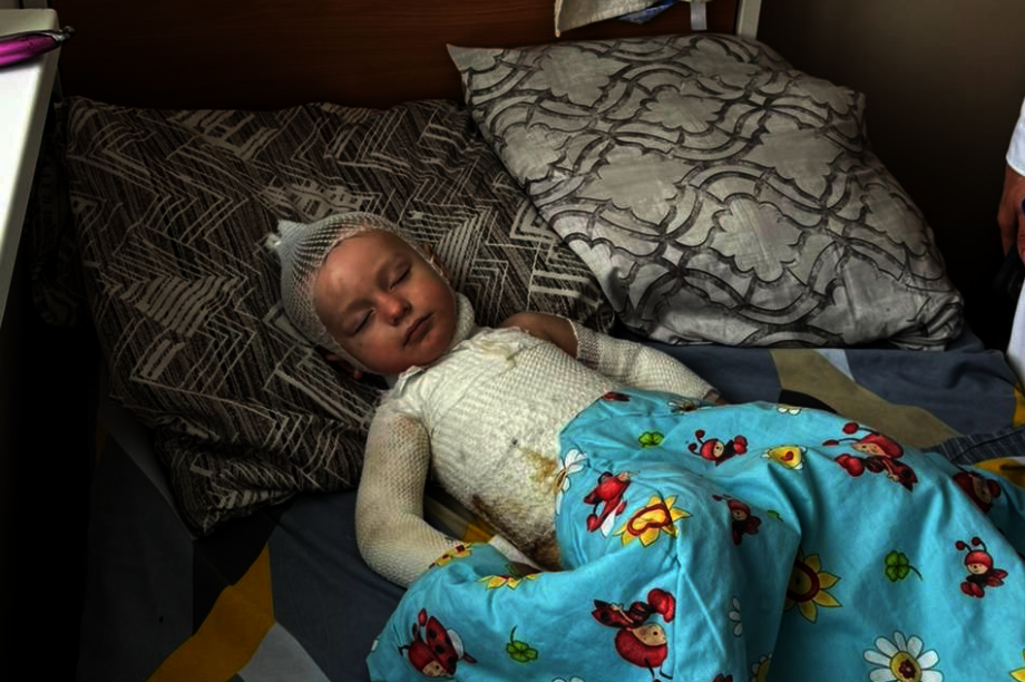 Healing Burned Children of War in Ukraine