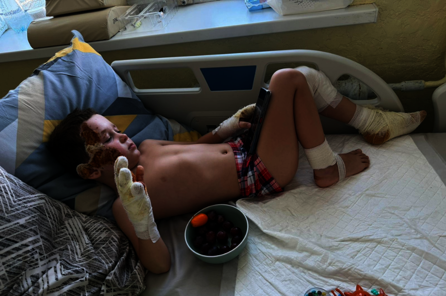 Healing Burned Children of War in Ukraine