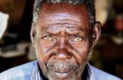 Fight Eyes Diseases, End Poverty in Tanzania