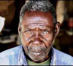 Fight Eyes Diseases, End Poverty in Tanzania