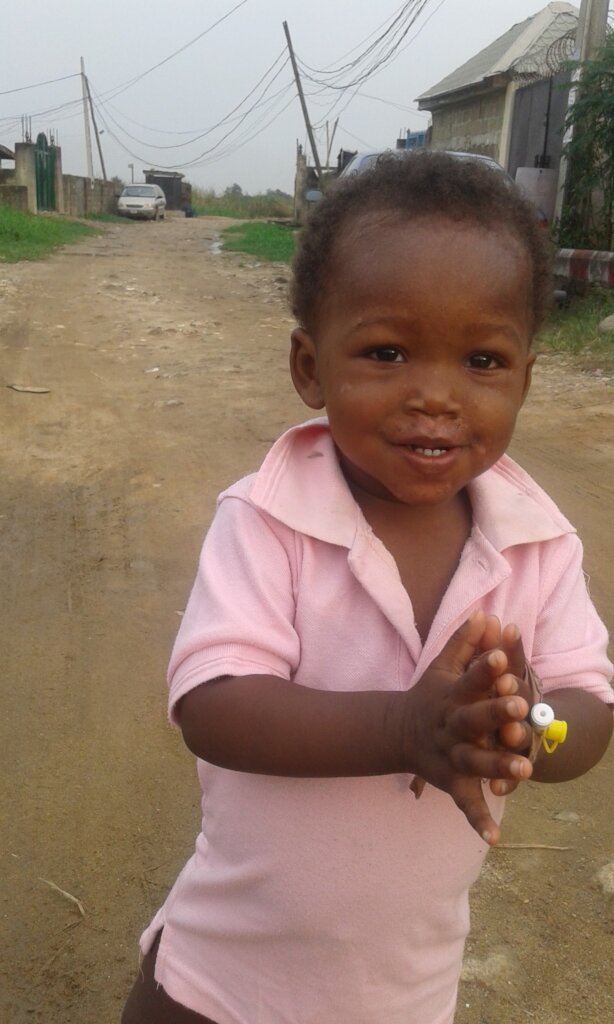 Enhanced Vaccines for Sickle Cell Kids in Nigeria