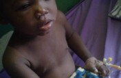Enhanced Vaccines for Sickle Cell Kids in Nigeria