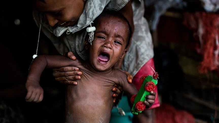 Fight DR Congo Epidemics: Ebola, Cholera, Mpox