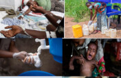 Fight DR Congo Epidemics: Ebola, Cholera, Mpox