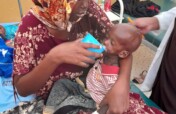Child Nutrition Crisis Response in Burhakaba.