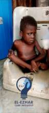 7 years old child with Severe acute malnutrition