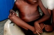Combating malnutrition and Nutrition Education