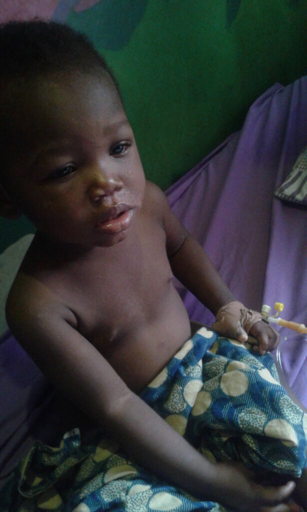 Keep 500 Sick Kids Alive in Crisis-Hit Communities