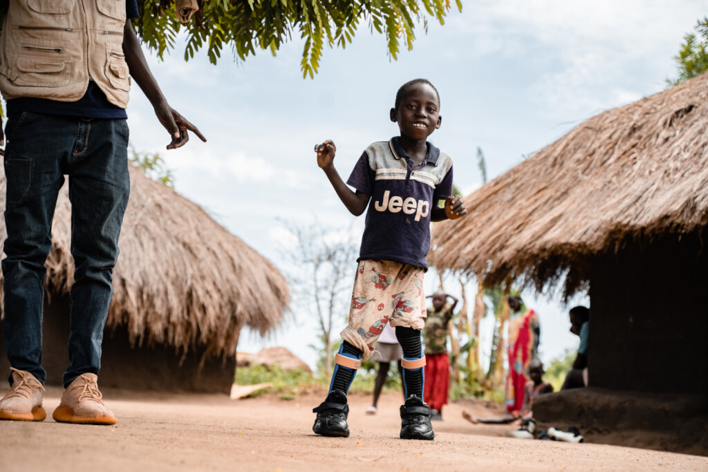Support Rehabilitation and Prosthetic Care
