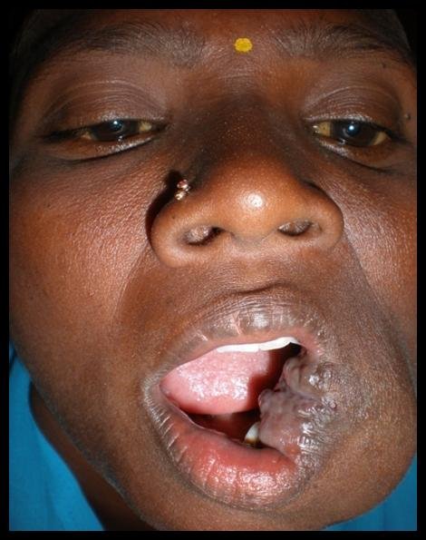 treat 200 patients  with facial deformities
