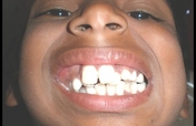  treat 200 patients  with facial deformities
