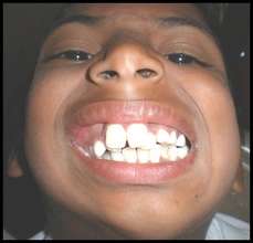 treat 200 patients  with facial deformities
