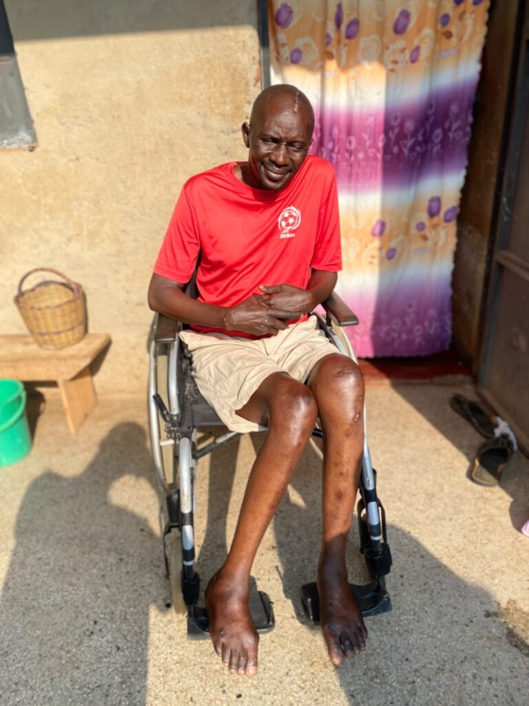 Francis can now sit, talk and smile