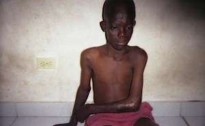 Jeznel, restavek slave child