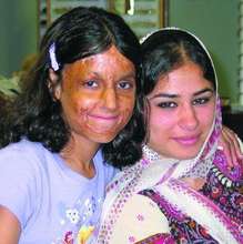 Healing Innocent Victims of War: Afghan Children