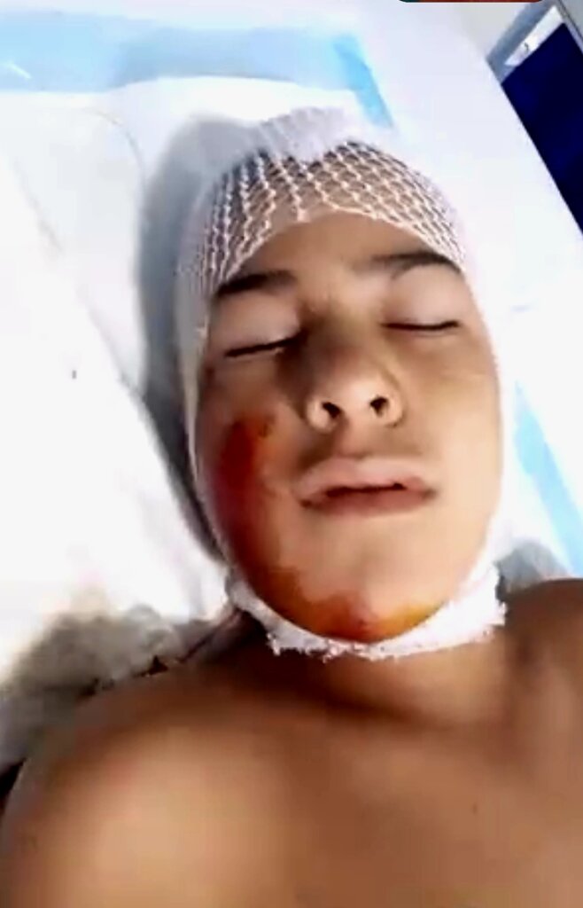 Gabriel's Recover After  Life-Threatening Acciden