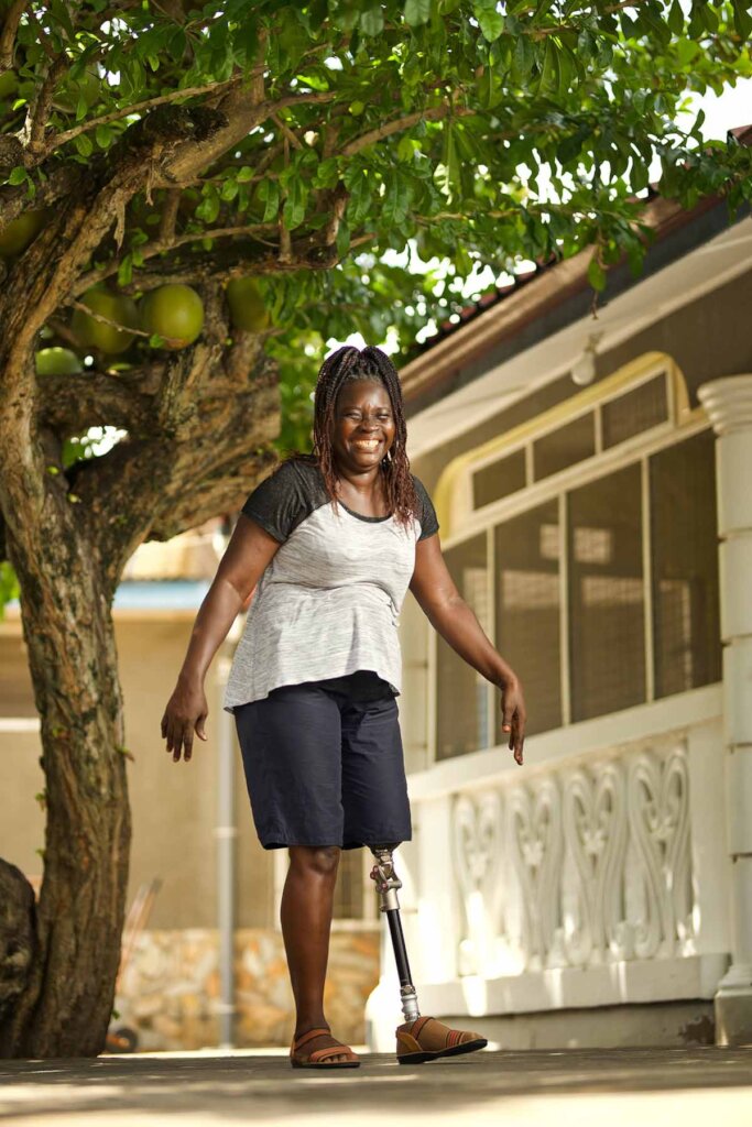 Restore mobility to 250 amputees in Ghana