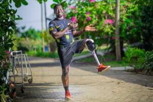 Issac from Ghana gets a new leg
