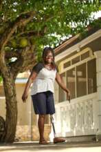 Connie from Ghana with her new leg