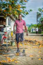 Faris with his donated leg.