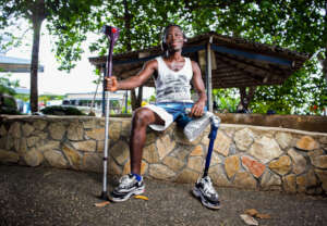 Restore mobility to 250 amputees in Ghana