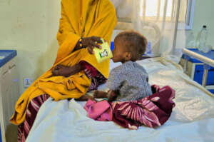 Malnourished child in Northern Nigeria