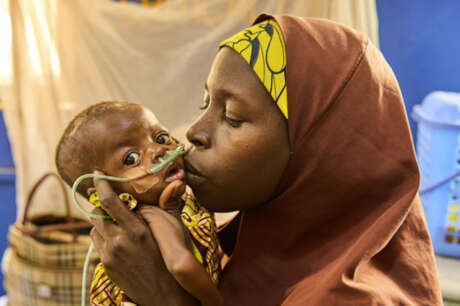 Help Save 100 Nigerian Children from Malnutrition