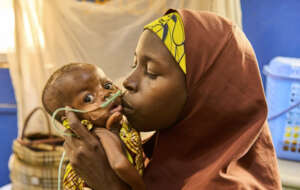 Help Save 100 Nigerian Children from Malnutrition