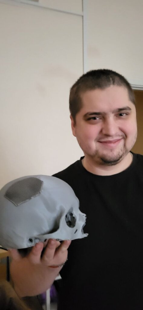 Rebuilding Faces for People Injured in the War