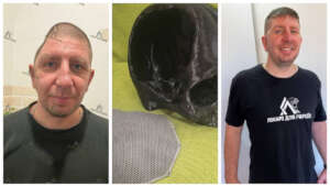 Patient-specific cranial implant
