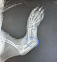 Mr. Cranky Pants pre-surgery xray