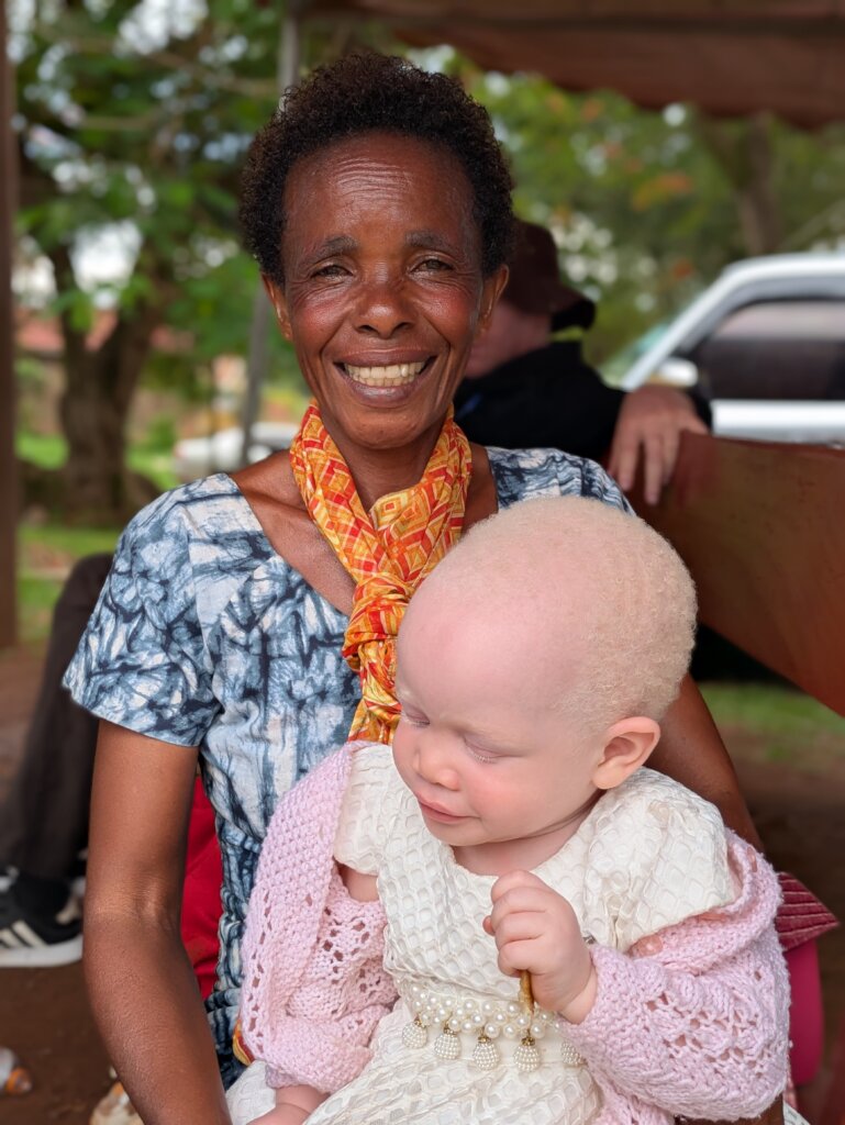 Child with albinism and her mother at the clinics