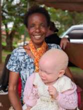 Child with albinism and her mother at the clinics