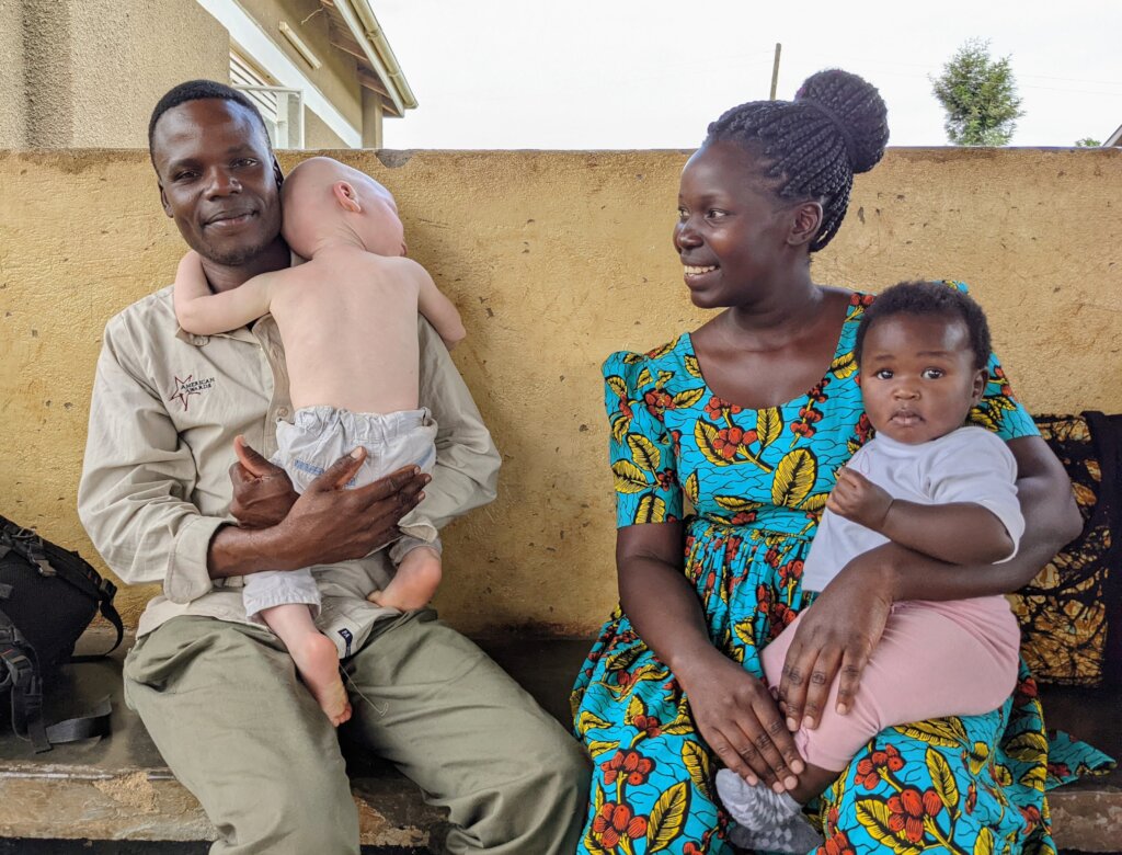 Life-saving skin checks for albinism in Uganda
