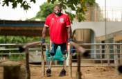Send 50 prosthetic legs to amputees in Benin