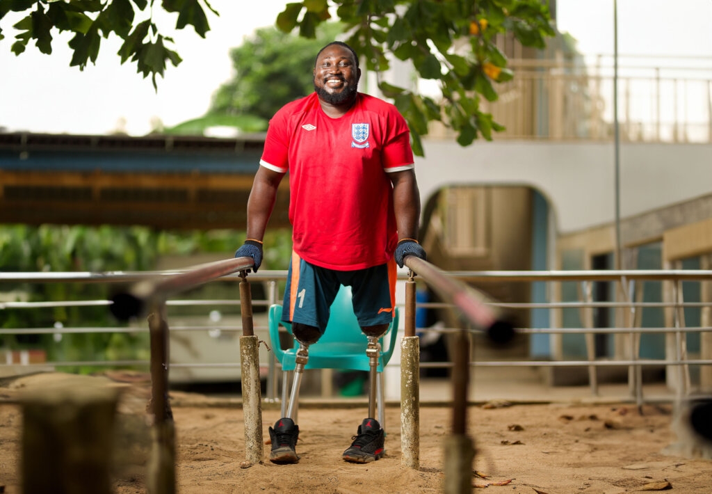 Send 50 prosthetic legs to amputees in Benin