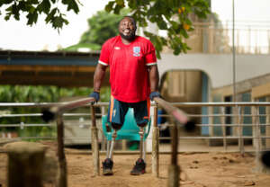 Send 50 prosthetic legs to amputees in Benin