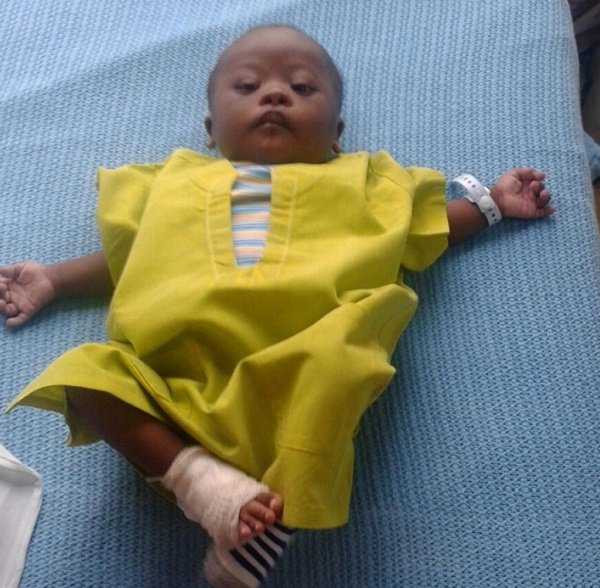 Baby Aqui after surgery