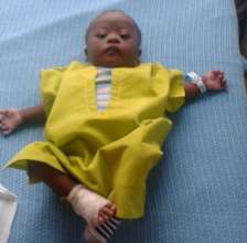 Baby Aqui after surgery