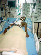 patient 2