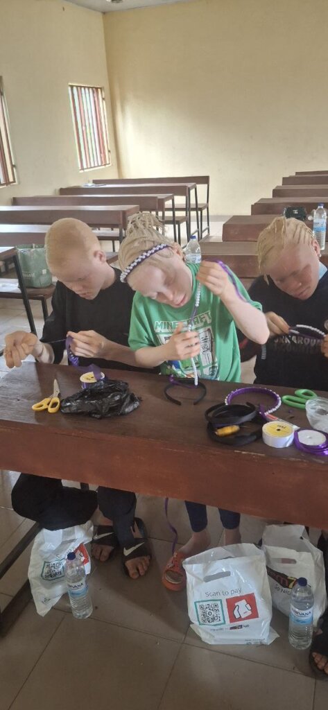 Save 50 Children with Albinism in from Skin Cancer