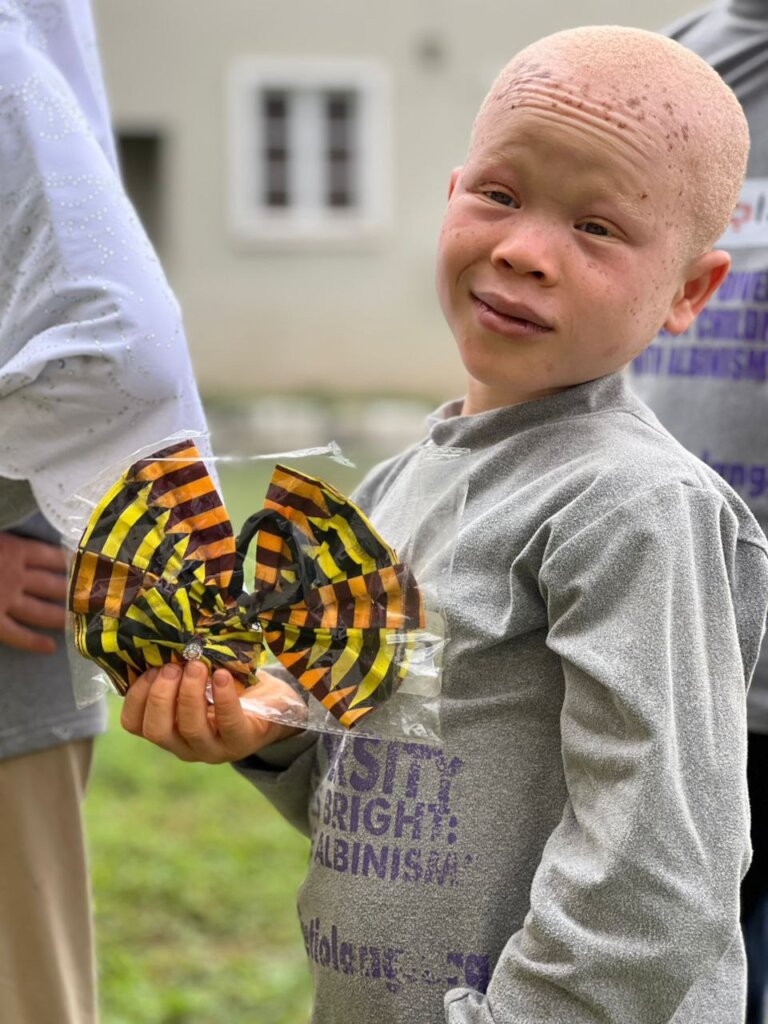 Save 50 Children with Albinism in from Skin Cancer