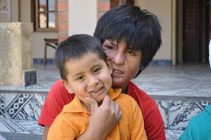 Roberto was burned on 45% of his body