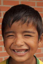 Bolivian boy to receive dental treatment